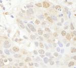 SET7 Antibody in Immunohistochemistry (Paraffin) (IHC (P))