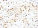 TOPORS Antibody in Immunohistochemistry (Paraffin) (IHC (P))