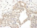 JAK2 Antibody in Immunohistochemistry (Paraffin) (IHC (P))