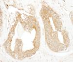 p600 Antibody in Immunohistochemistry (Paraffin) (IHC (P))