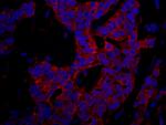 p600 Antibody in Immunohistochemistry (Paraffin) (IHC (P))