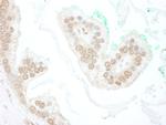 BTBD12 Antibody in Immunohistochemistry (Paraffin) (IHC (P))