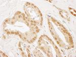 TIGAR Antibody in Immunohistochemistry (Paraffin) (IHC (P))