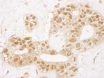 TIGAR Antibody in Immunohistochemistry (Paraffin) (IHC (P))