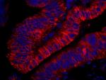 ARHGEF5 Antibody in Immunohistochemistry (Paraffin) (IHC (P))