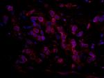 ARID4B Antibody in Immunohistochemistry (Paraffin) (IHC (P))