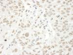 ARID4B Antibody in Immunohistochemistry (Paraffin) (IHC (P))