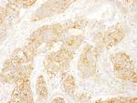 eIF3B/EIF3S9 Antibody in Immunohistochemistry (Paraffin) (IHC (P))