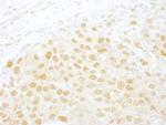 NCBP1/CBP80 Antibody in Immunohistochemistry (Paraffin) (IHC (P))