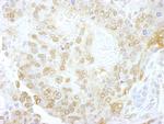 NCBP1/CBP80 Antibody in Immunohistochemistry (Paraffin) (IHC (P))