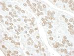 POLR3D Antibody in Immunohistochemistry (Paraffin) (IHC (P))