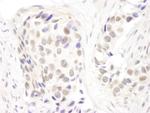 p66alpha Antibody in Immunohistochemistry (Paraffin) (IHC (P))