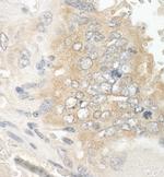 EB1 Antibody in Immunohistochemistry (Paraffin) (IHC (P))