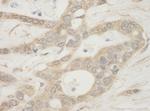 BAD Antibody in Immunohistochemistry (Paraffin) (IHC (P))