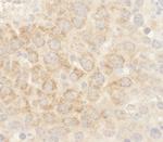 BAD Antibody in Immunohistochemistry (Paraffin) (IHC (P))