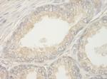 BAD Antibody in Immunohistochemistry (Paraffin) (IHC (P))