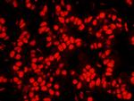 NPM1 Antibody in Immunohistochemistry (Paraffin) (IHC (P))