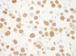 NPM1 Antibody in Immunohistochemistry (Paraffin) (IHC (P))