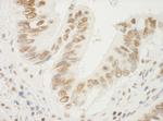 NPM1 Antibody in Immunohistochemistry (Paraffin) (IHC (P))