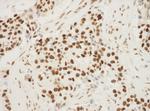 NPM1 Antibody in Immunohistochemistry (Paraffin) (IHC (P))