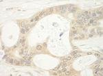 BHD Antibody in Immunohistochemistry (Paraffin) (IHC (P))