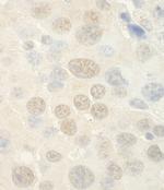 WDR5 Antibody in Immunohistochemistry (Paraffin) (IHC (P))