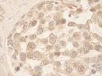 SRPK1 Antibody in Immunohistochemistry (Paraffin) (IHC (P))