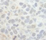 SRPK1 Antibody in Immunohistochemistry (Paraffin) (IHC (P))