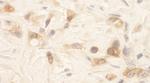 SPAK Antibody in Immunohistochemistry (Paraffin) (IHC (P))