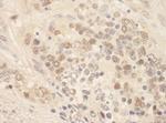 ZEB2/SIP Antibody in Immunohistochemistry (Paraffin) (IHC (P))