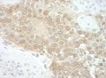 RuvBL2 Antibody in Immunohistochemistry (Paraffin) (IHC (P))