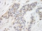 CDK8 Antibody in Immunohistochemistry (Paraffin) (IHC (P))