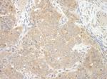 NEDD4L Antibody in Immunohistochemistry (Paraffin) (IHC (P))