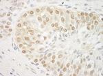 ARID3B Antibody in Immunohistochemistry (Paraffin) (IHC (P))