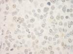 FOXP1 Antibody in Immunohistochemistry (Paraffin) (IHC (P))