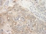 ZCCHC11 Antibody in Immunohistochemistry (Paraffin) (IHC (P))