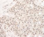 EYA2 Antibody in Immunohistochemistry (Paraffin) (IHC (P))