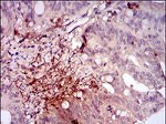 ILK Antibody in Immunohistochemistry (Paraffin) (IHC (P))