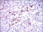 INCENP Antibody in Immunohistochemistry (Paraffin) (IHC (P))