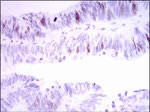 INCENP Antibody in Immunohistochemistry (Paraffin) (IHC (P))