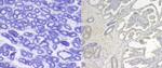 CD41 Antibody in Immunohistochemistry (Paraffin) (IHC (P))