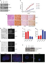 CD29 (Integrin beta 1) Antibody in Immunocytochemistry (ICC/IF)