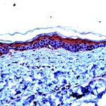 Involucrin Antibody in Immunohistochemistry (Paraffin) (IHC (P))