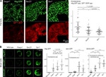 COPII Antibody in Immunocytochemistry (ICC/IF)