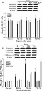 PSME1 Antibody in Western Blot (WB)