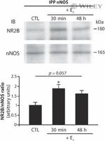 NMDAR2B Antibody in Western Blot (WB)