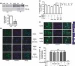 NMDAR2B Antibody in Western Blot (WB)