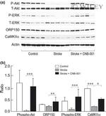 CaMKII alpha Antibody in Western Blot (WB)