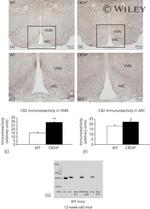 CNR2 Antibody in Immunohistochemistry (Paraffin) (IHC (P))