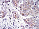 gamma Catenin Antibody in Immunohistochemistry (Paraffin) (IHC (P))